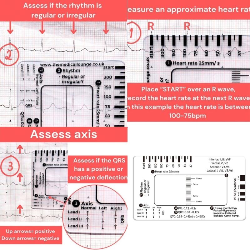 Ecg Ruler Card Pocket EKG 7 Step Ruler Card EKG Interpretation Guide Card For EKG ...